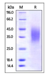 Mouse BTLA, His Tag on SDS-PAGE under reducing (R) condition. The gel was stained overnight with Coomassie Blue. The purity of the protein is greater than 95%.